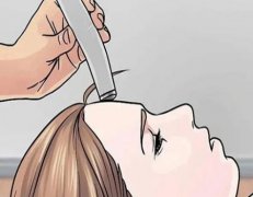 疤痕修复后颜色多久恢复正常？疤痕修复过程中会不会发痒?