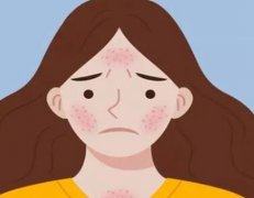 光子嫩肤能紧致提升吗？光子嫩肤可以深入到皮肤深层