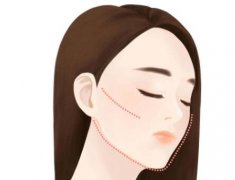 埋线提升可以维持多久？分析项目基本原理和恢复时间